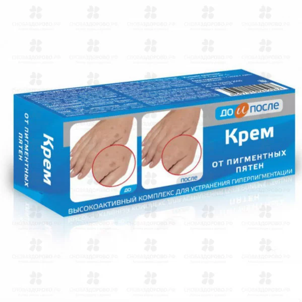 До и После крем от пигментных пятен 50мл  ✅ 34319/06898 | Сноваздорово.рф